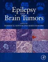 Epilepsy And Brain Tumors