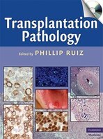 Transplantation Pathology