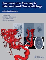 Neurovascular Anatomy in Interventional Neuroradiology: A 