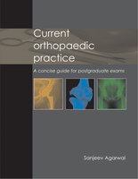 Current Orthopaedic Practice: A Concise Guide For Postgraduate Exams