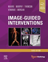 Image-Guided Interventions: Expert Radiology Series