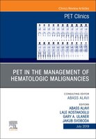 Pet In The Management Of Hematologic Malignancies, An Issue Of Pet Clinics