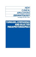 tumours, Lymphomas And Selected Paraproteinaemias