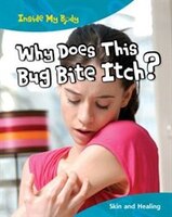 Why Does This Bug Bite Itch?: Skin and Healing