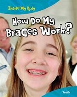 How Do My Braces Work?: Teeth