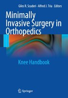 Minimally Invasive Surgery in Orthopedics: Knee Handbook