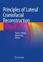 ISBN 9783030502935 product image for Principles Of Lateral Craniofacial Reconstruction | upcitemdb.com