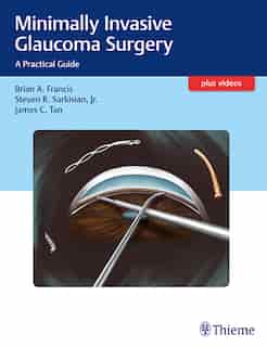 Minimally Invasive Glaucoma Surgery: A Practical Guide by Brian Francis