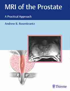 Mri Of The Prostate: A Practical Approach by Andrew Rosenkrantz