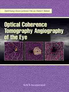 Optical Coherence Tomography Angiography Of The Eye: Oct Angiography by David Huang