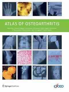 Atlas of Osteoarthritis by Nigel Arden