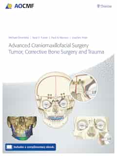 Advanced Craniomaxillofacial Surgery: Tumor, Corrective Bone Surgery, And Trauma by Michael Ehrenfeld
