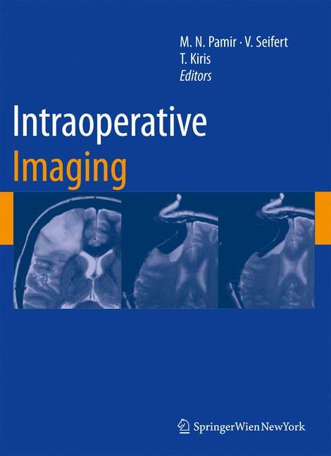 Intraoperative Imaging by M. Necmettin Pamir Hardcover | Indigo Chapters