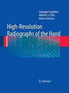 High-Resolution Radiographs of the Hand by Giuseppe Guglielmi