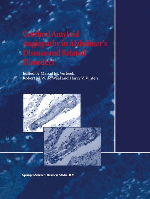 Cerebral Amyloid Angiopathy in Alzheimer's Disease and Related Disorders by M.M. Verbeek Paperback | Indigo Chapters