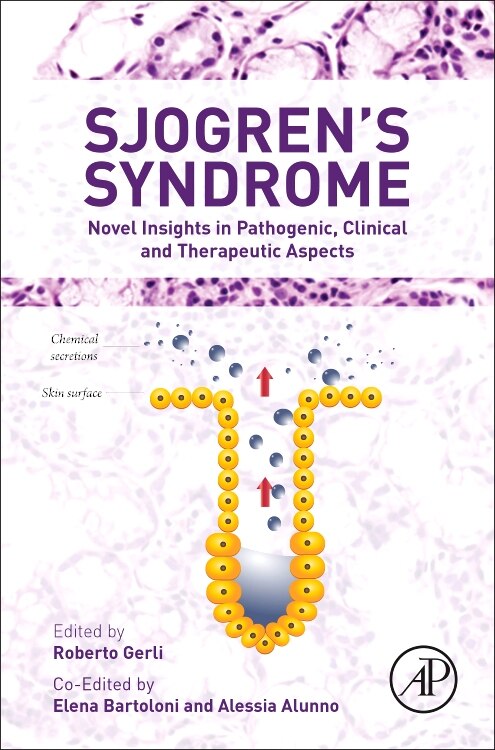 Sjogren's Syndrome by Alessia Alunno, Hardcover | Indigo Chapters