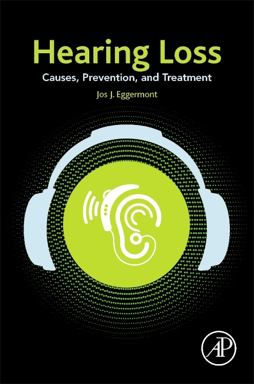 Hearing Loss by Jos J. Eggermont, Hardcover | Indigo Chapters