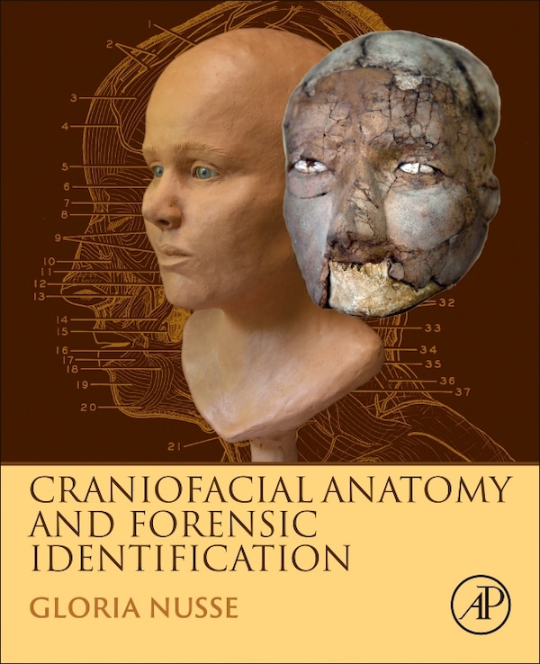Craniofacial Anatomy And Forensic Identification by Gloria Nusse, Hardcover | Indigo Chapters