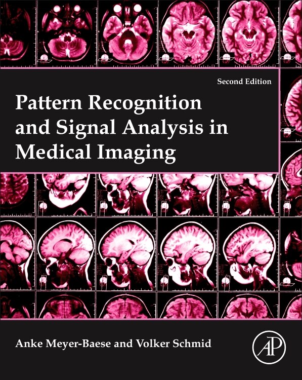 Pattern Recognition And Signal Analysis In Medical Imaging by Anke Meyer-baese, Paperback | Indigo Chapters