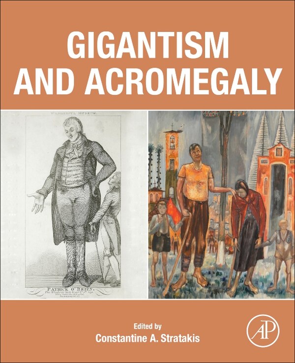 Gigantism and Acromegaly by Constantine A. Stratakis, Paperback | Indigo Chapters