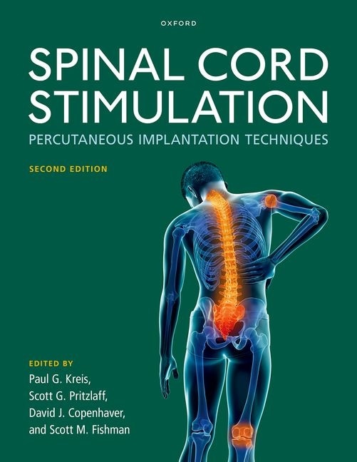 Spinal Cord Stimulation by James E. Boggan, Hardcover | Indigo Chapters