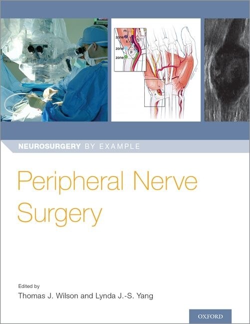 Peripheral Nerve Neurosurgery by Thomas Wilson, Paperback | Indigo Chapters