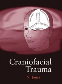 Craniofacial Trauma by Nick Jones, Hardcover | Indigo Chapters