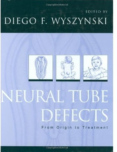 Neural Tube Defects by Diego F. Wyszynski, Hardcover | Indigo Chapters