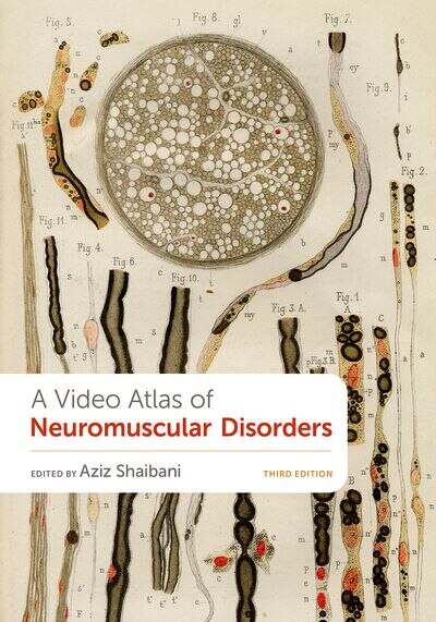 A Video Atlas of Neuromuscular Disorders by Aziz Shaibani, Paperback | Indigo Chapters
