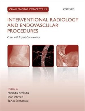 Challenging Concepts in Interventional Radiology by Miltiadis Krokidis, Paperback | Indigo Chapters