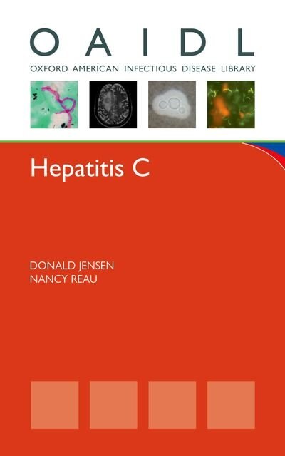 Hepatitis C by Donald Jensen, Paperback | Indigo Chapters
