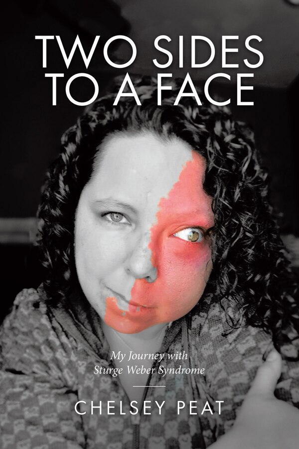 Two Sides to a Face by Chelsey Peat, Paperback | Indigo Chapters