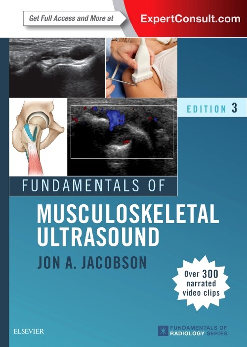 Fundamentals Of Musculoskeletal Ultrasound by Jon A. Jacobson, Paperback | Indigo Chapters