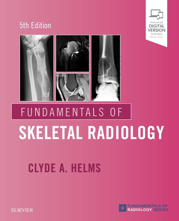 Fundamentals Of Skeletal Radiology by Clyde A. Helms, Paperback | Indigo Chapters