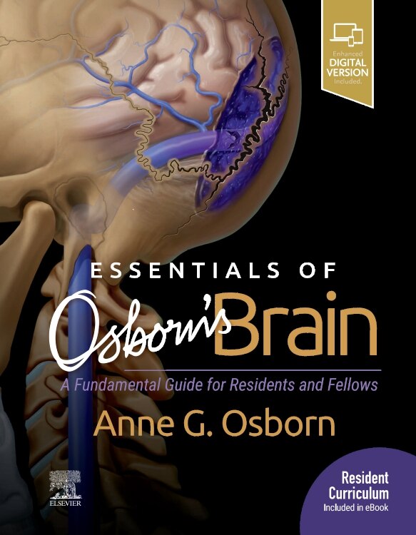 Essentials Of Osborn's Brain by Anne G. Osborn, Hardcover | Indigo Chapters