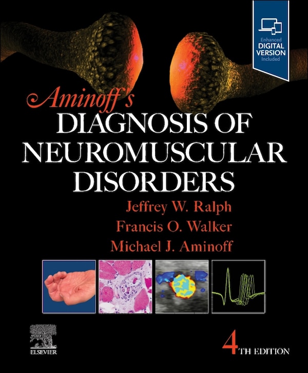 Aminoff's Diagnosis of Neuromuscular Disorders by Michael J. Aminoff, Hardcover | Indigo Chapters