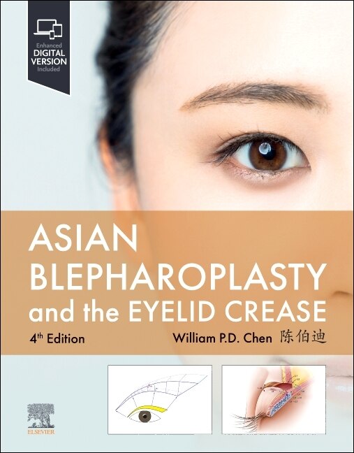 Asian Blepharoplasty and the Eyelid Crease by William P. Chen, Hardcover | Indigo Chapters