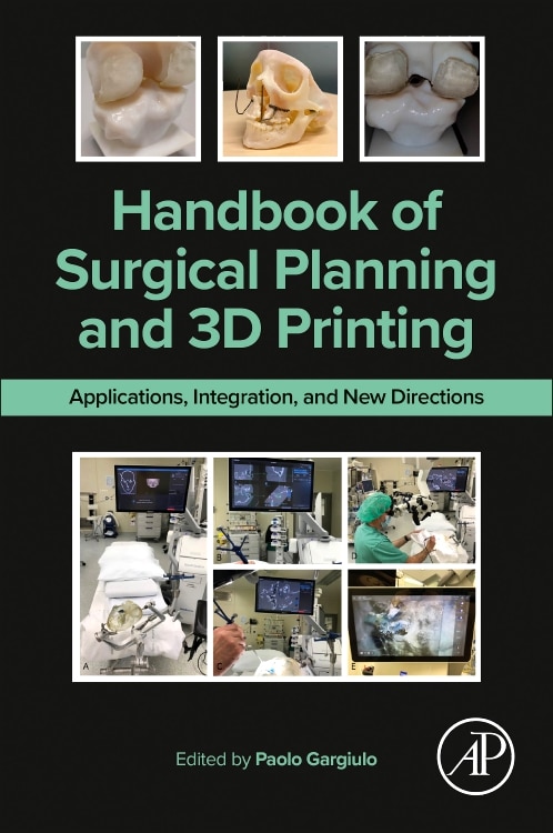 Handbook of Surgical Planning and 3D Printing by Paolo Gargiulo, Paperback | Indigo Chapters