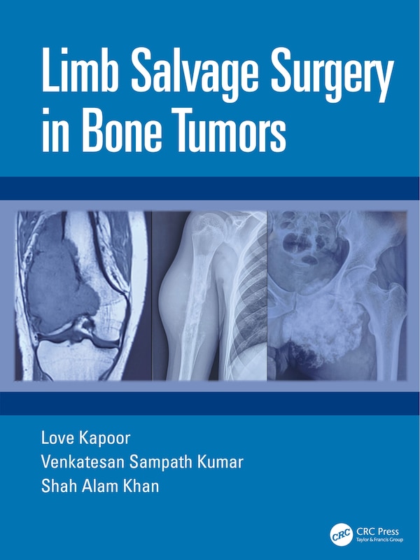 Limb Salvage Surgery in Bone Tumors by Love Kapoor, Hardcover | Indigo Chapters
