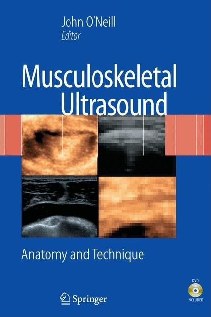 Musculoskeletal Ultrasound by John M. D. O'Neill, Hardcover | Indigo Chapters