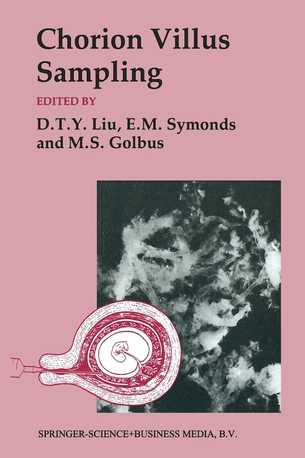 Chorion Villus Sampling by Mitchell S Golbus, Paperback | Indigo Chapters