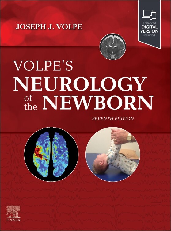 Volpe's Neurology of the Newborn by Joseph J. Volpe, Hardcover | Indigo Chapters