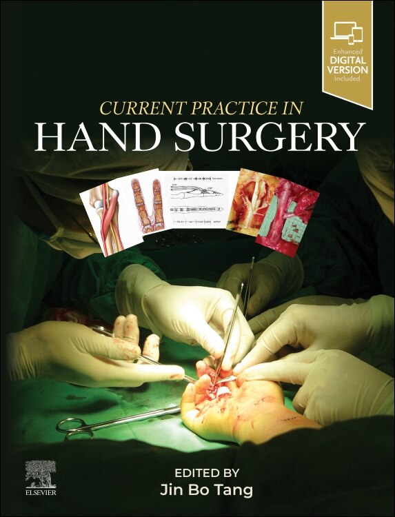 Current Practice in Hand Surgery by Jin Bo Tang, Hardcover | Indigo Chapters