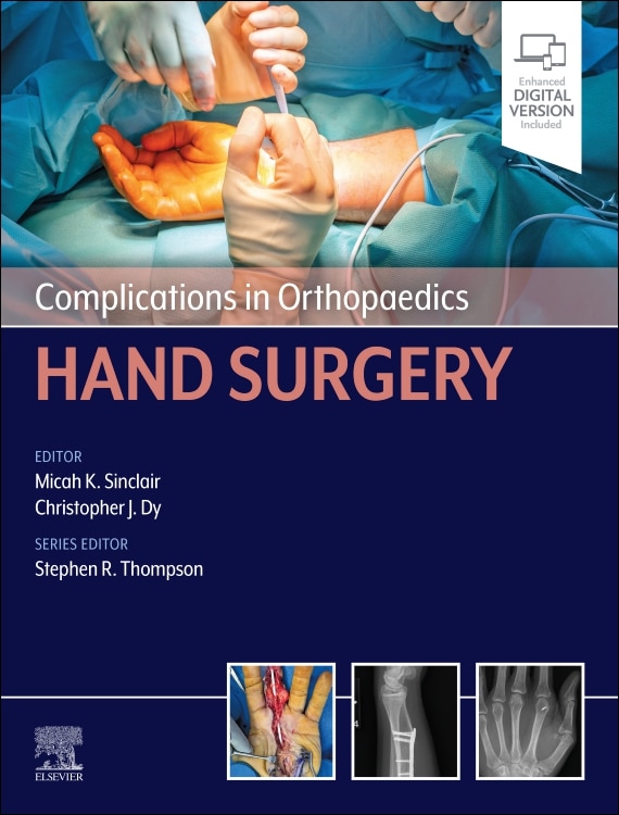 Complications in Orthopaedics by Micah K. Sinclair, Hardcover | Indigo Chapters