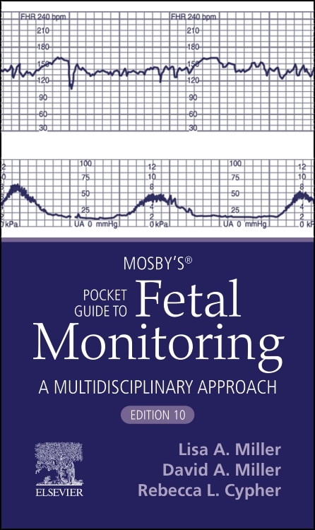 Mosby's Pocket Guide to Fetal Monitoring by Lisa A. Miller, Paperback | Indigo Chapters