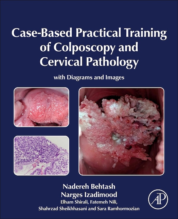 Case-Based Practical Training of Colposcopy and Cervical Pathology by Nadereh Behtash, Hardcover | Indigo Chapters