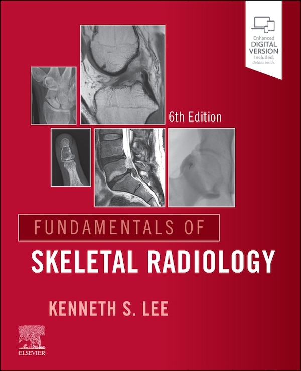 Helms - Fundamentals of Skeletal Ra by Kenneth S. Lee, Paperback | Indigo Chapters