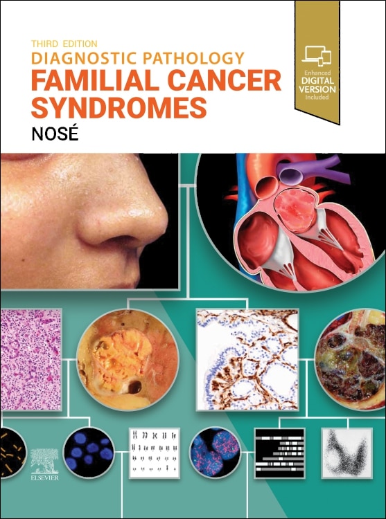 Diagnostic Pathology by Vania Nos, Hardcover | Indigo Chapters