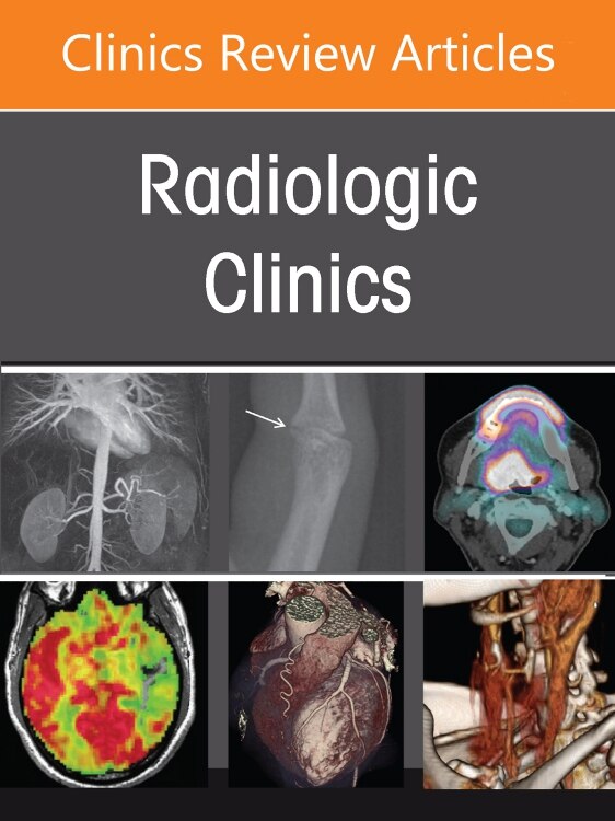 Advances in Pediatric Imaging An Issue of Radiologic Clinics of North America by Edward Y. Lee, Hardcover | Indigo Chapters