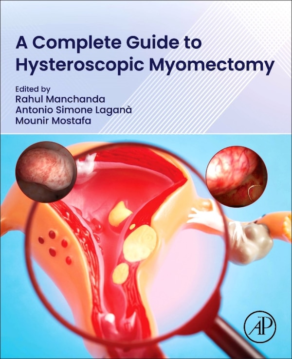 A Complete Guide to Hysteroscopic Myomectomy by Rahul Manchanda, Paperback | Indigo Chapters